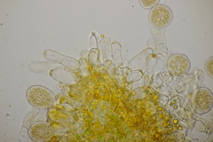 Naohidemyces vacciniorum