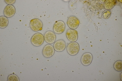 Naohidemyces vacciniorum