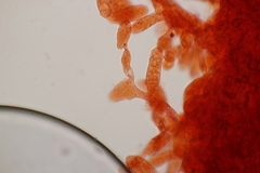 Inocybaceae