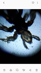 Pediculus humanus capitis