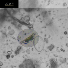 Amphora bigibba