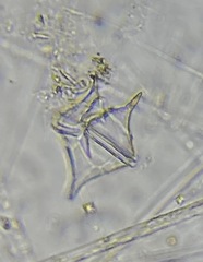 Protoperidinium