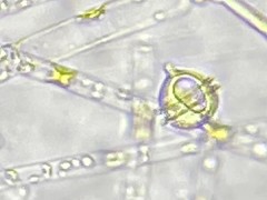 Protoperidinium