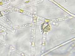 Protoperidinium