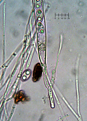 Tarzetta cupularis