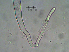 Tarzetta cupularis