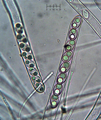 Tarzetta cupularis
