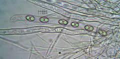 Tarzetta cupularis