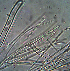 Tarzetta cupularis