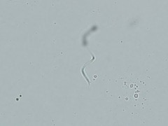 Monoraphidium contortum