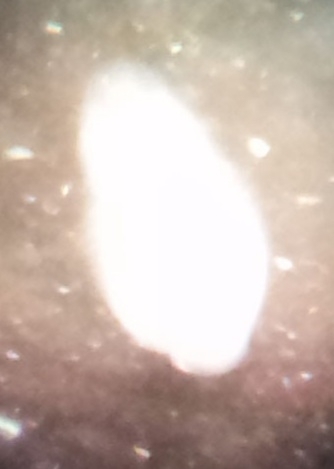 Diplostomum