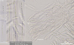 Coccomyces coronatus