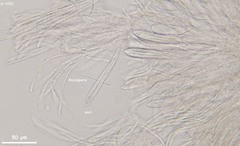 Coccomyces coronatus