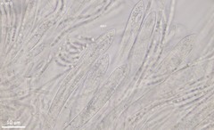 Coccomyces coronatus