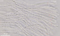 Coccomyces coronatus