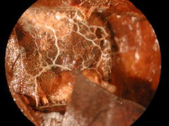 Ophiotheca chrysosperma