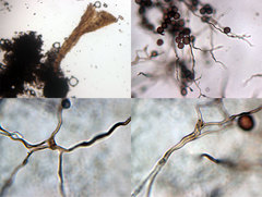 Didymium squamulosum