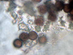 Didymium squamulosum