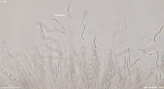 Cercophora silvatica