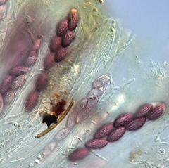 Ascobolus furfuraceus