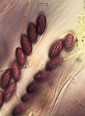 Ascobolus furfuraceus