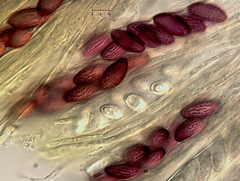 Ascobolus furfuraceus