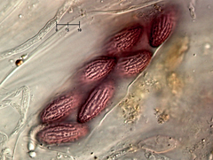 Ascobolus furfuraceus