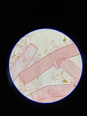 Botryosporium