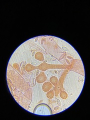 Botryosporium
