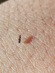 Coleosoma