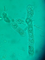 Entomophthora schizophorae