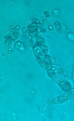 Entomophthora schizophorae