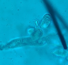 Entomophthora schizophorae