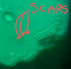 Entomophthora schizophorae