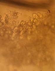 Entomophthora schizophorae