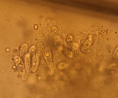 Entomophthora schizophorae