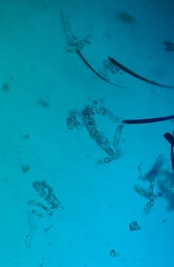 Entomophthora schizophorae