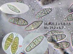 Fusarium sambucinum