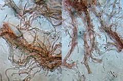 Hohenbuehelia cyphelliformis