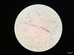 Peziza atrovinosa