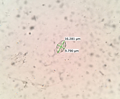 Peziza atrovinosa
