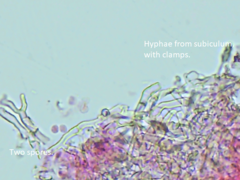 Hyphodontia arguta