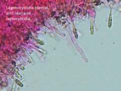 Hyphodontia arguta