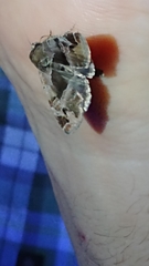 Homophoberia apicosa