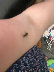 Insecta
