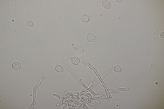 Ramularia sphaeroidea