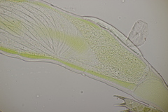 Hesperomyces harmoniae