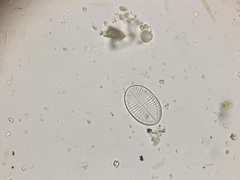 Cocconeis