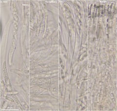 Hymenoscyphus albidus