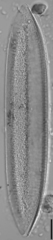 Tryblionella hantzschiana